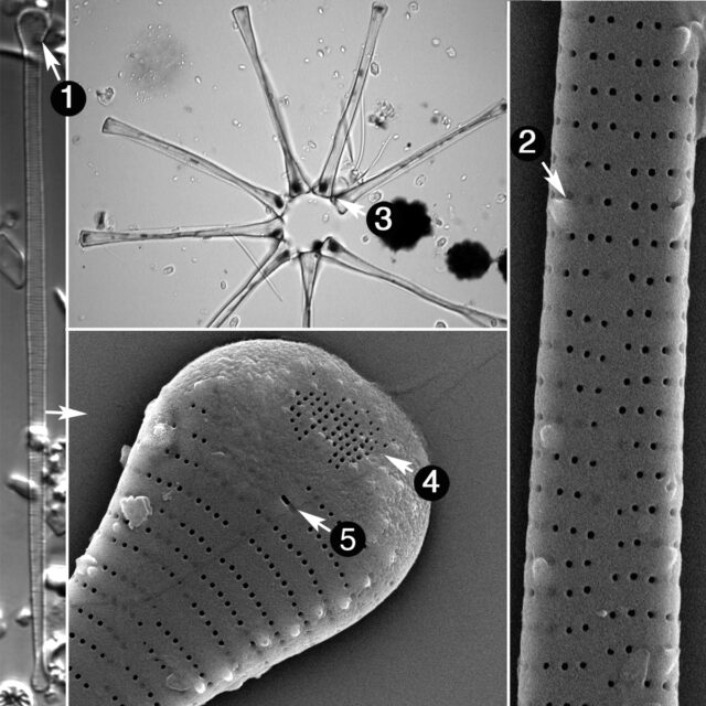 Asterionella | Genera - Diatoms of North America