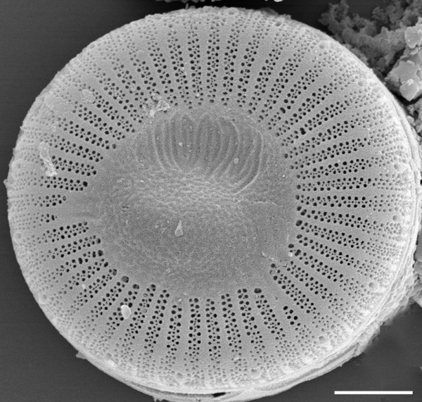 Cdistinuenda 2Micron Scale 600X572