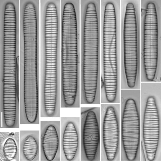 Diatomavulgaris