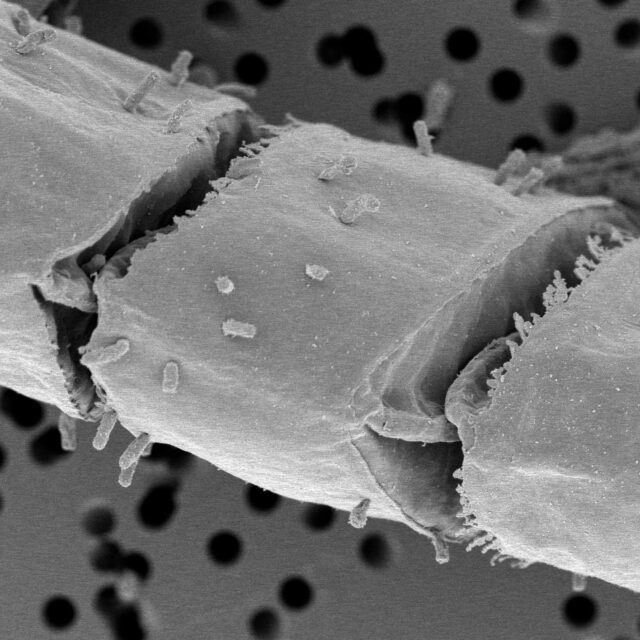 Epithemia catenata uncleaned SEM03