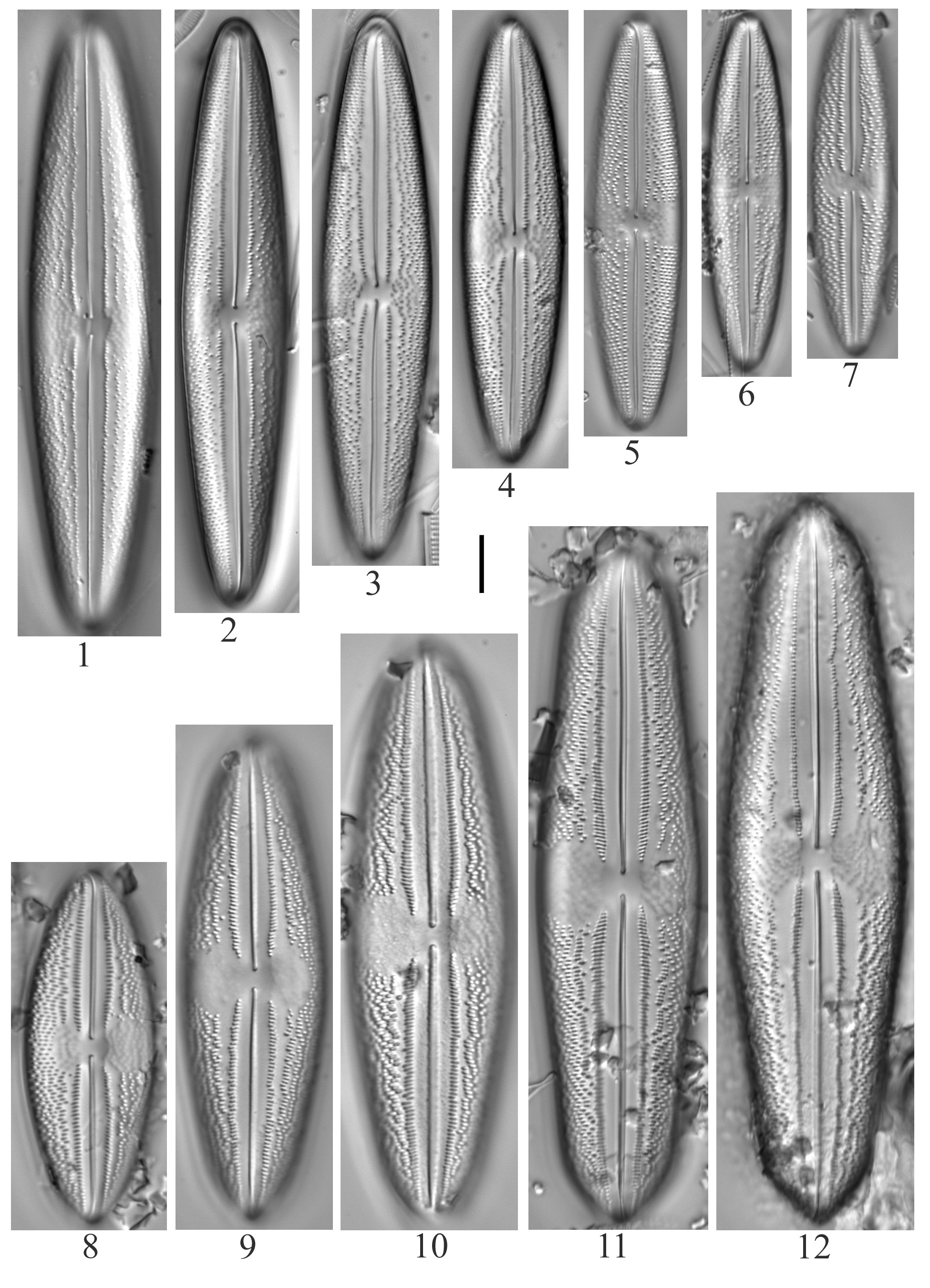 Anomoeoneis Costata Sensulato 1