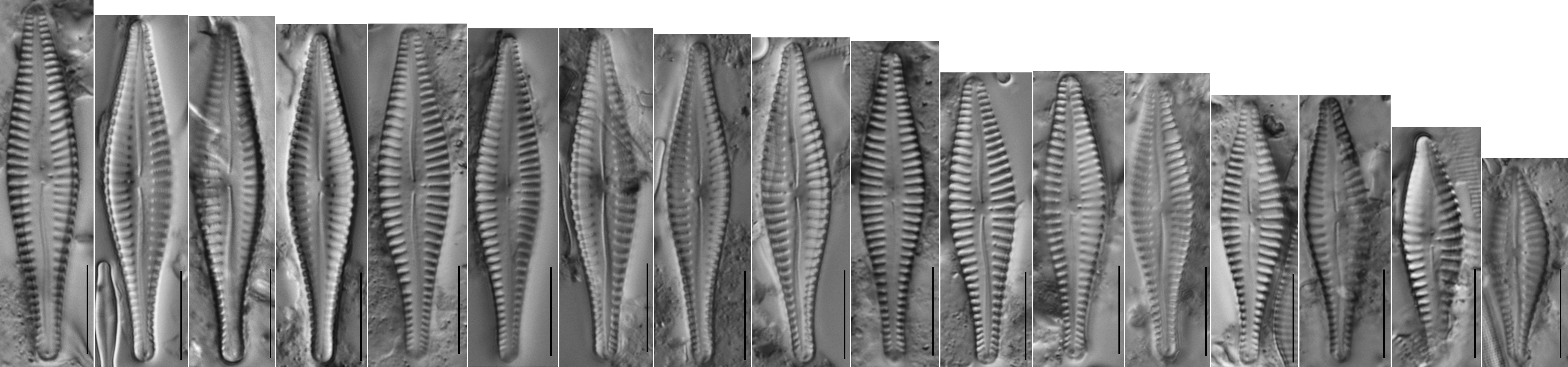 Gomphonema Gibba Plate  Fl