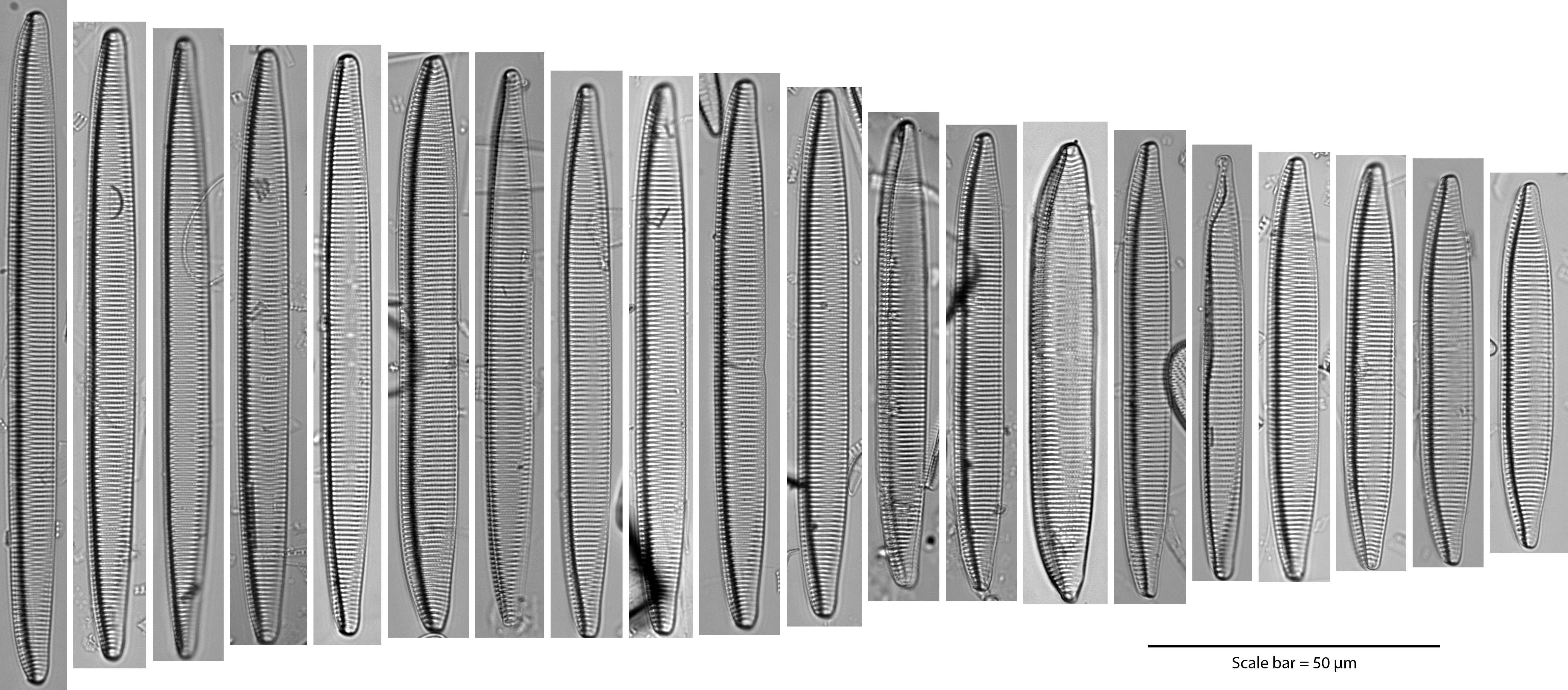 Tryblionella brunoi Size Series