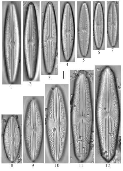 Anomoeoneis Costata Sensulato 1