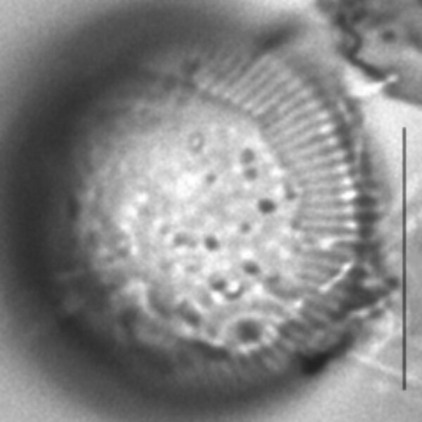 Cyclotella Rossi Initial Valve