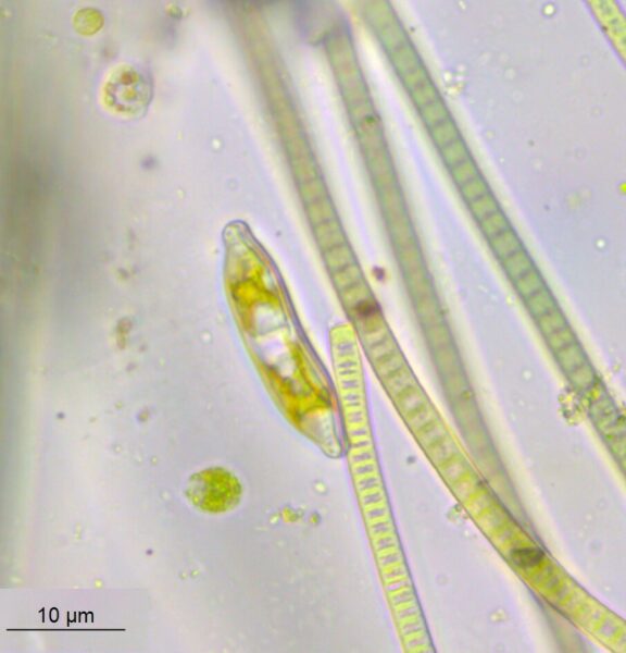 Hantzschia amphioxys live