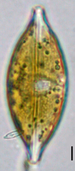 Lakeside Micrographs 2 063  Anom Sph  Sandspit  Mbay