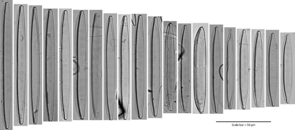 Tryblionella brunoi Size Series