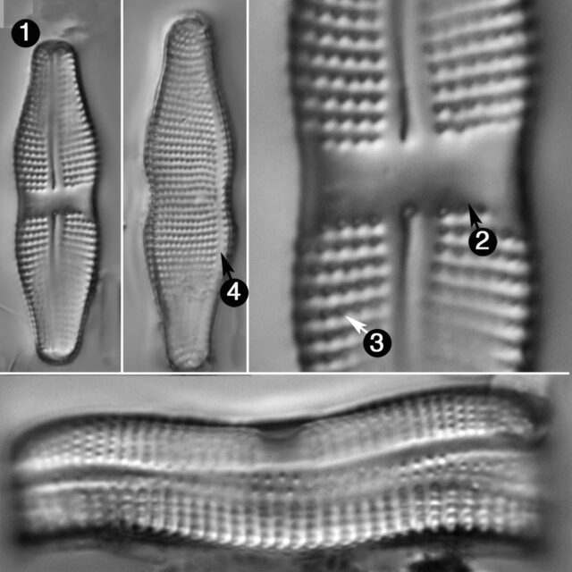 Achnanthes Coarctata Guide