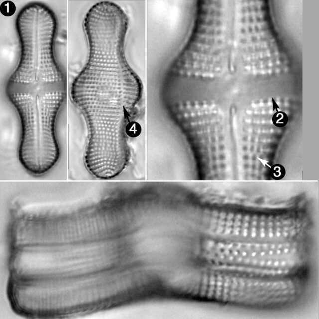 Achnanthes Inflata Guide