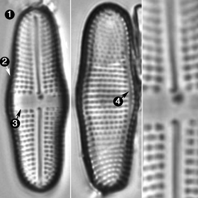 Achnanthes Tumescens Guide