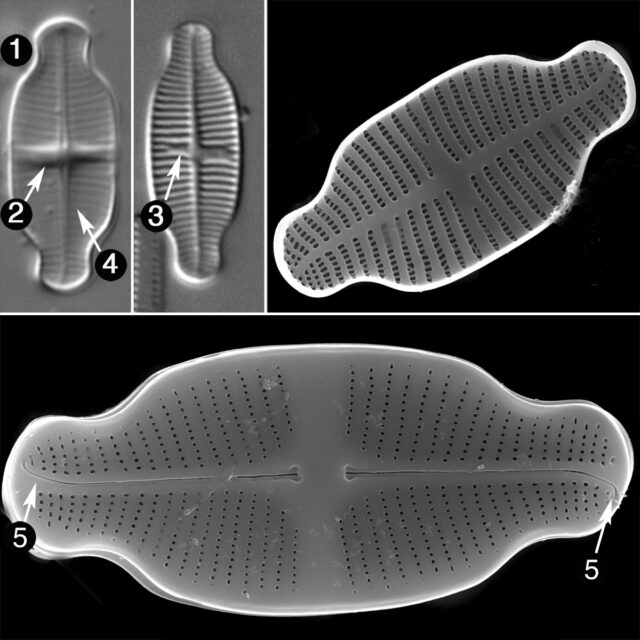 Achnanthidium Exiguum Guide