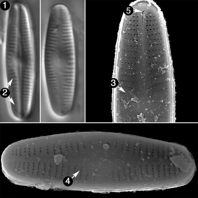 Achnanthidium Kranzii Guide