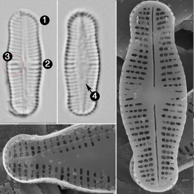 Achnanthidium Rosenstockii Guide