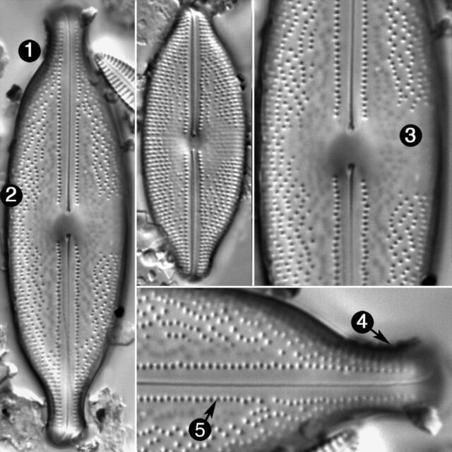 Anomoeoneis Sphaerophora Guide