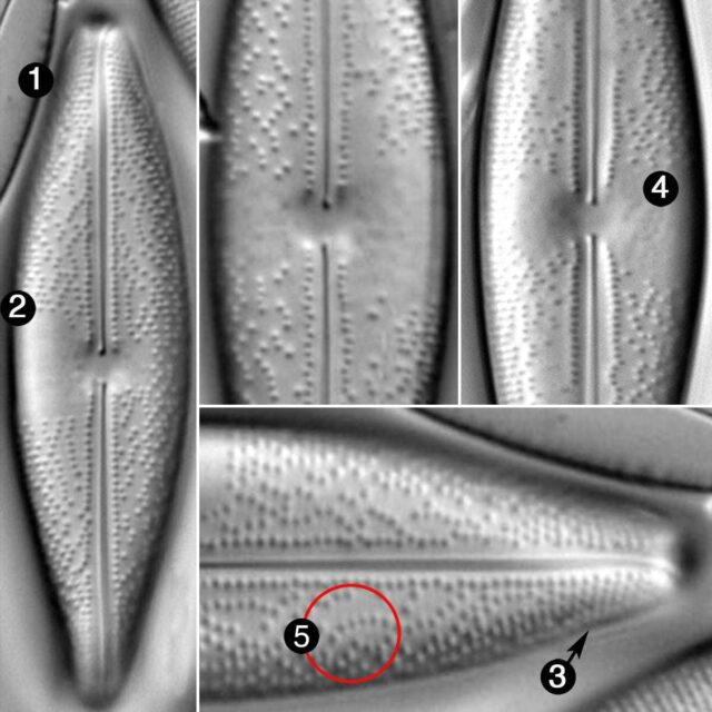 Anomoeoneis Sphaerophora Rostrata Guide