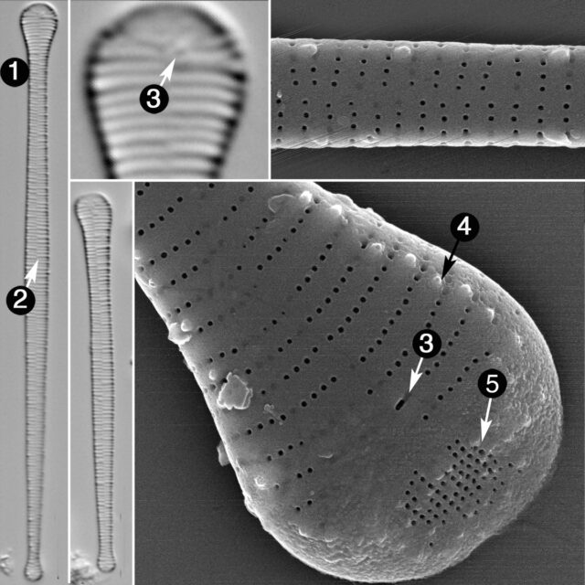 Asterionella Formosa Guide