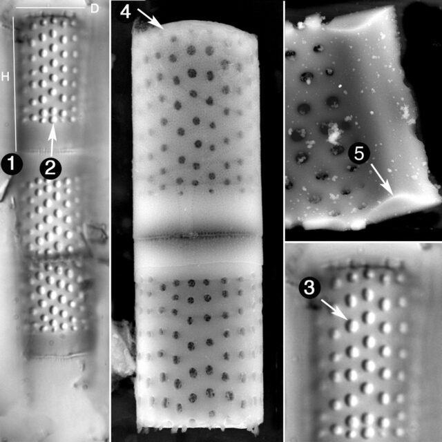 Aulacoseira Crassipunctata Guide