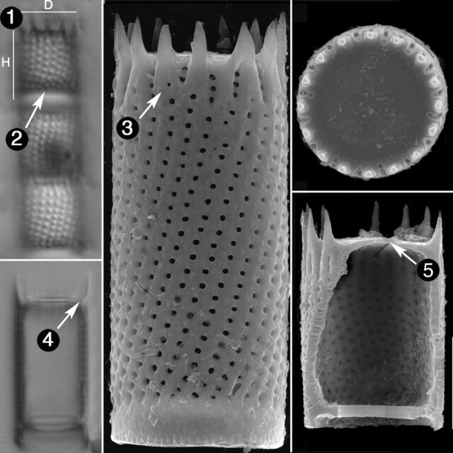 Aulacoseira Subarctica Guide