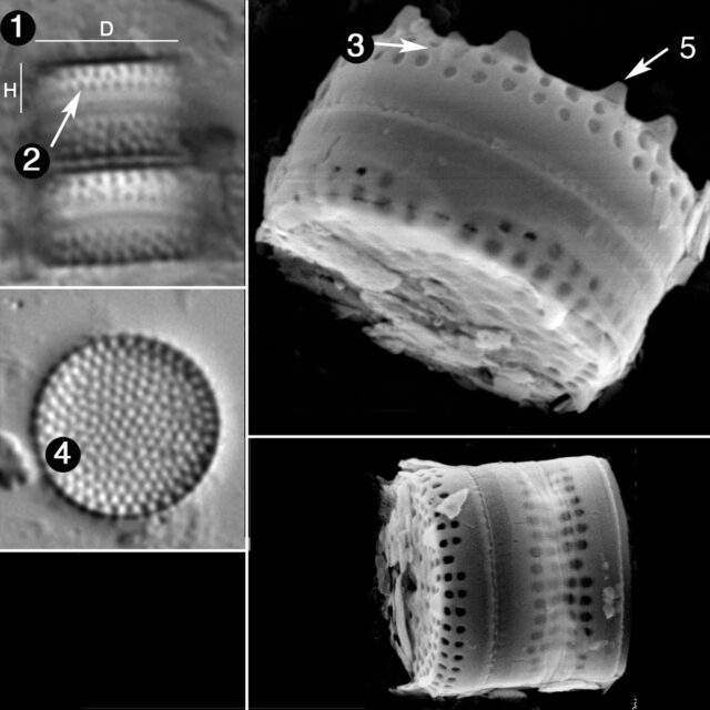 Aulacoseira Tenella Guide