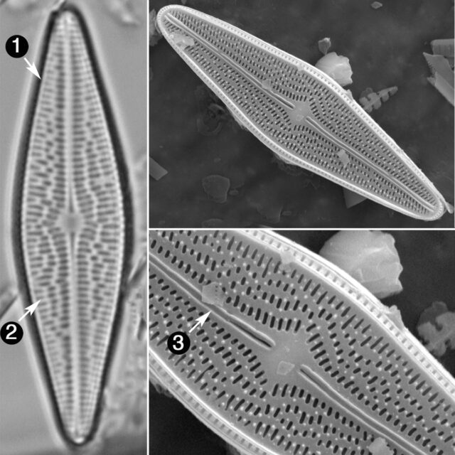 Brachysira Brebissonii Guide