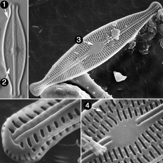 Brachysira Microcephala