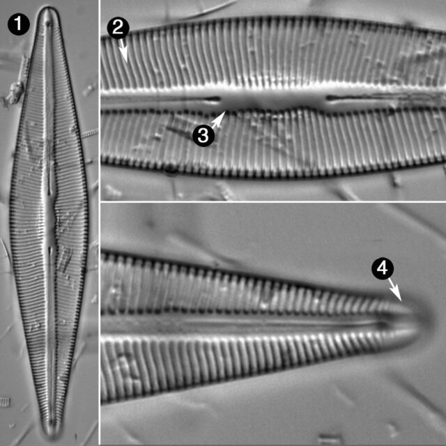 Brebissonia Lanceolata Guide