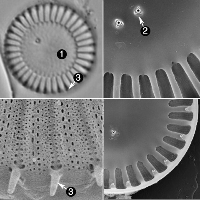 Cyclotella Meneghiniana Guide