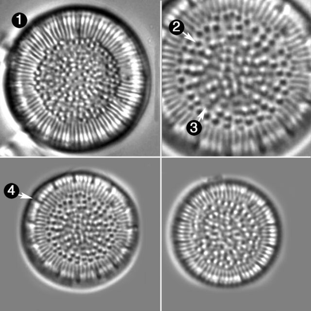 Cyclotella Praetermissa Guide