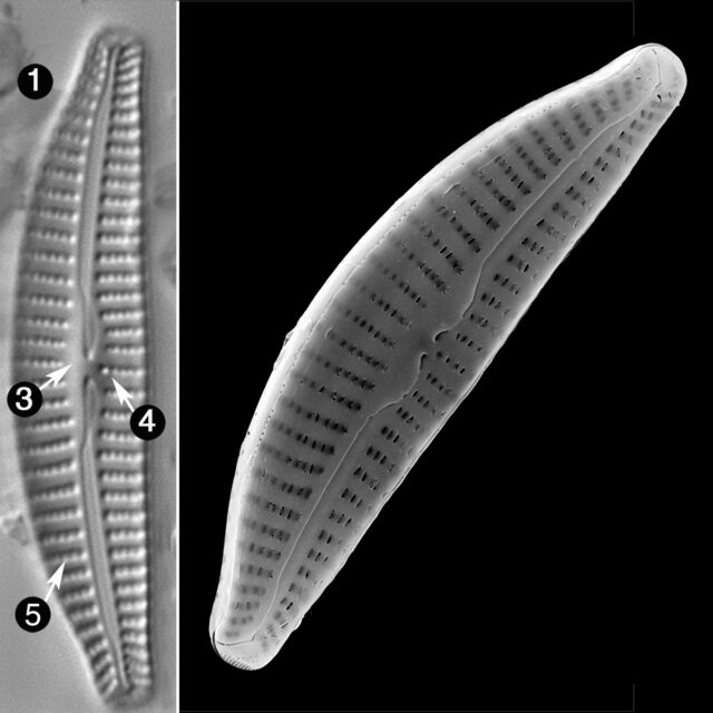 Cymbella Excisiformis Guide