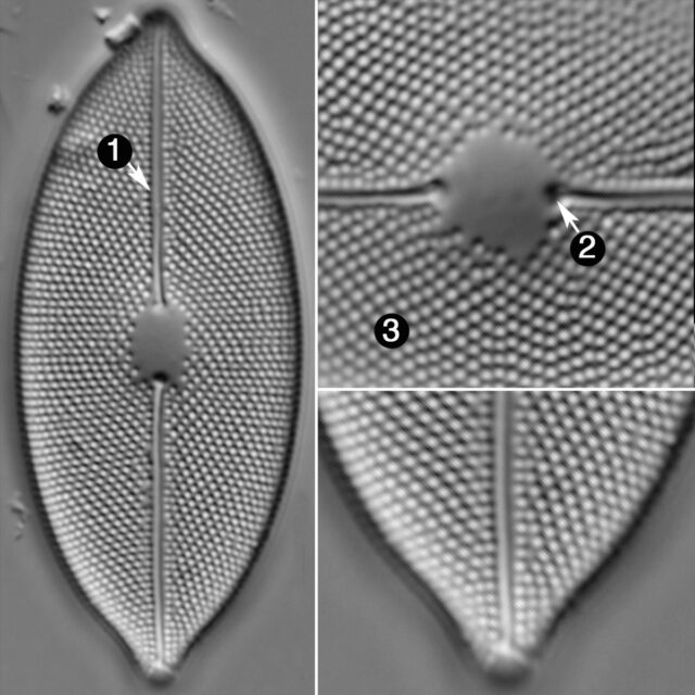 Decussata Placentual Guide