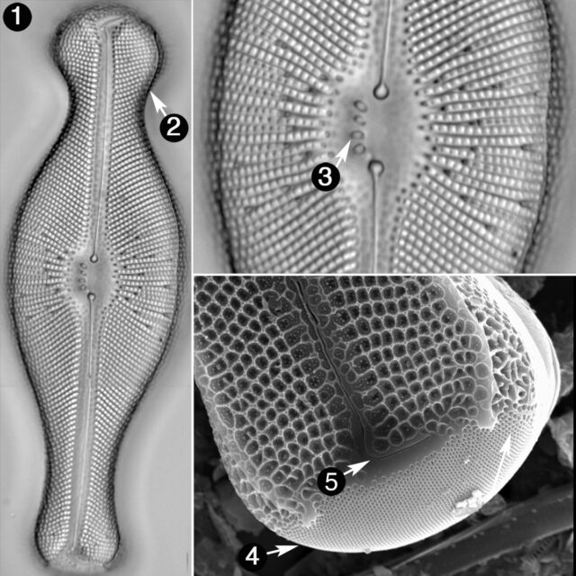 Didymosphenia Geminata Guide