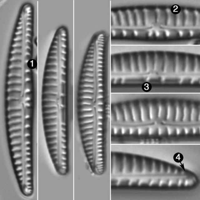 Encyonema Paucistriatum Guide