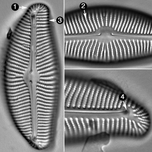 Encyonema Prostratum Guide