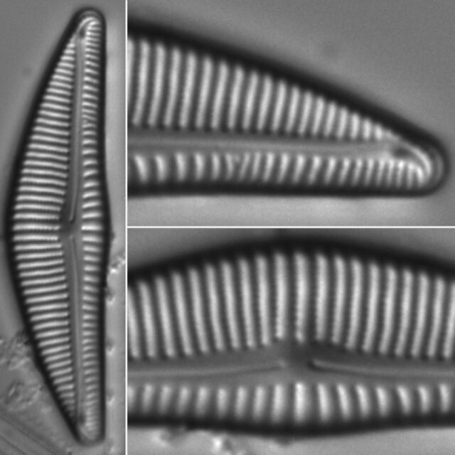 Encyonema Silesiacum Guide