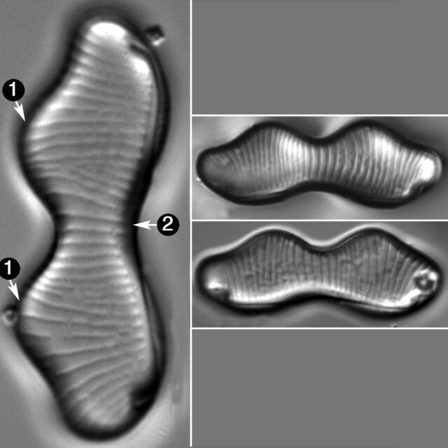 Eunotia Gibbosa Guide