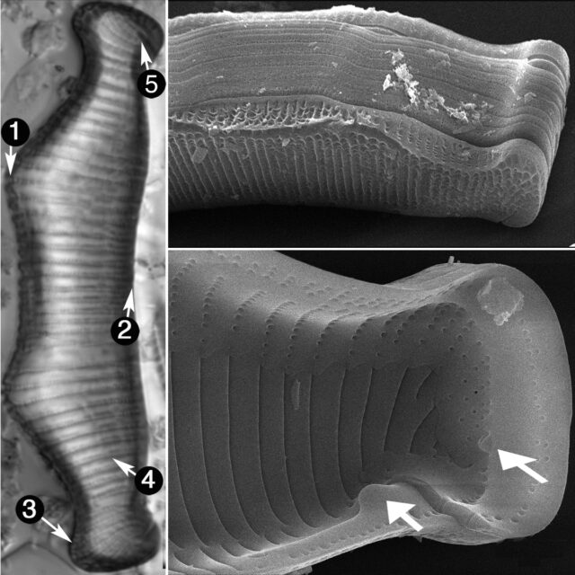 Eunotia Montuosa Guide