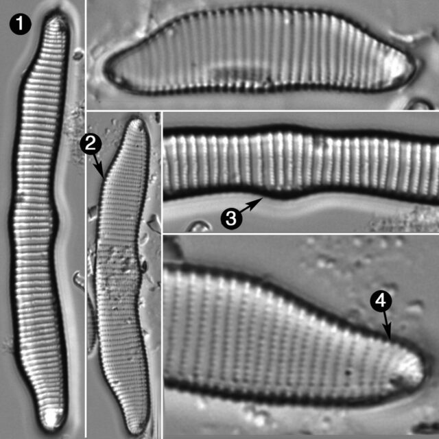 Eunotia Pectinalis Guide