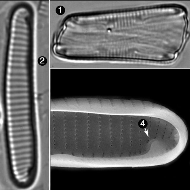 Eunotia Rhomboidea Guide