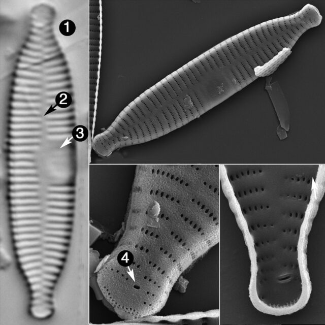 Fragilaria Recapitellata Guide