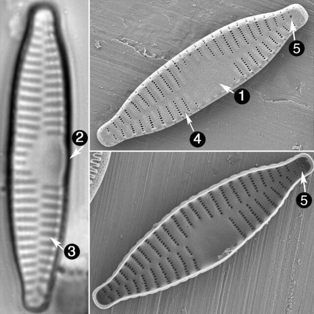 Fragilaria Vaucheriae Guide