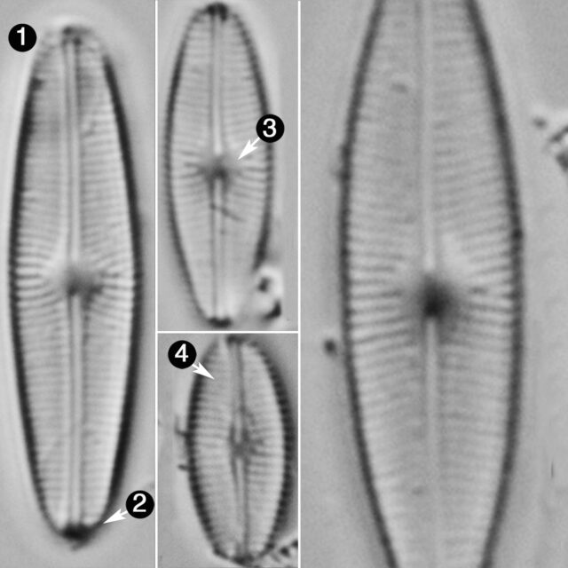 Genkalia Digitulus Guide