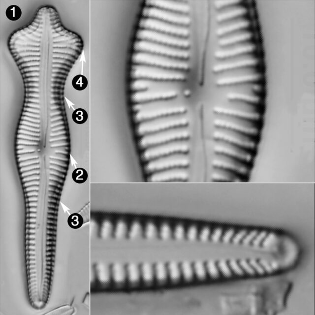 Gomphonema Acuminatum Guide