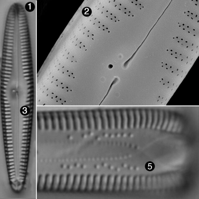 Gomphonema Amerhombicum Guide