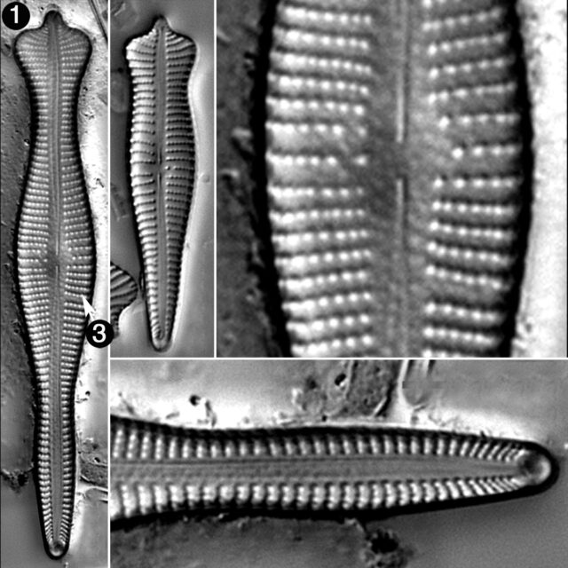 Gomphonema Coronatum Guide