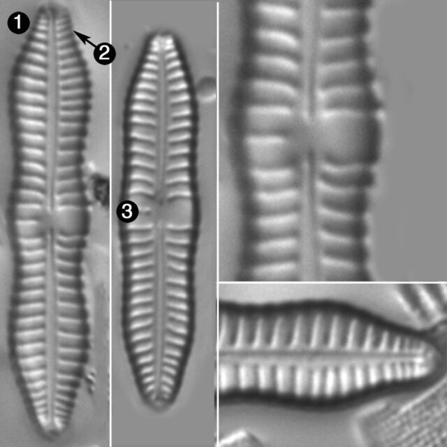 Gomphonema Distans Guide