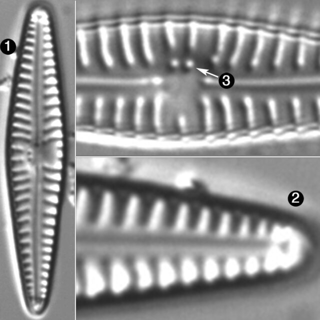 Gomphonema Duplipunctatum Guide