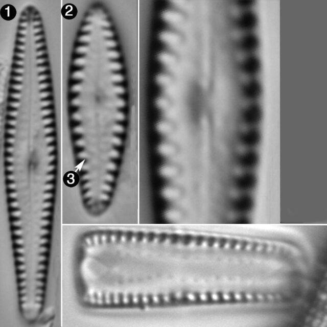 Gomphonema Louisiananum Guide