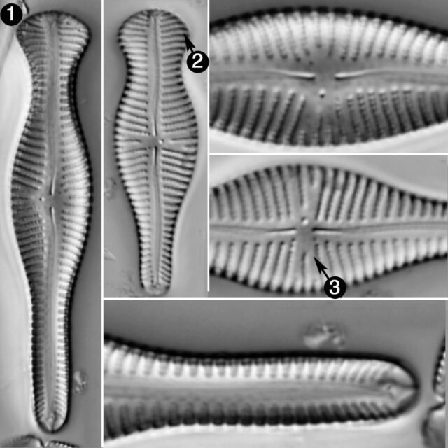 Gomphonema Truncatum Guide