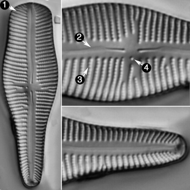 Gomphonema Turgidum Guide